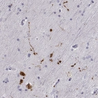 Immunohistochemical staining of human hippocampus using Anti-RUNDC3A antibody HPA023548.