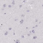 Immunohistochemical staining of human cerebral cortex using Anti-RUNDC3A antibody HPA023548.