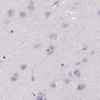 Immunohistochemical staining of human cerebral cortex using Anti-RUNDC3A antibody HPA023548.