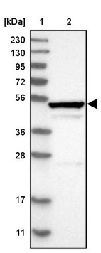 Lane 1: Marker [kDa] 230, 130, 95, 72, 56, 36, 28, 17, 11_br/_Lane 2: Human cell line RT-4
