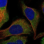Immunofluorescent staining of human cell line U-2 OS shows localization to vesicles.
