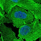 Immunofluorescent staining of human cell line U-2 OS shows localization to nucleoplasm, plasma membrane & cell junctions.