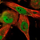 Immunofluorescent staining of human cell line U-251 MG shows localization to nucleoplasm & vesicles.