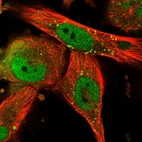 Immunofluorescent staining of human cell line U-251 MG shows localization to nucleoplasm & vesicles.