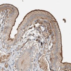 Anti-CTBP2 Antibody