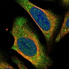 Immunofluorescent staining of human cell line U-2 OS shows localization to cytosol.