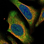 Immunofluorescent staining of human cell line U-2 OS shows localization to cytosol.