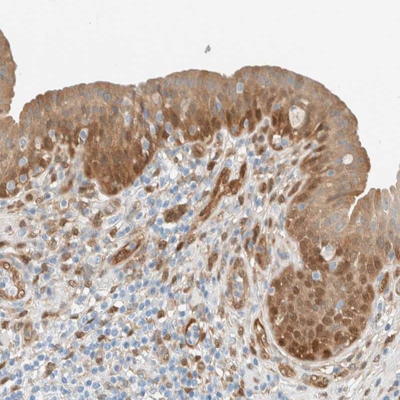 Anti-NXN Antibody