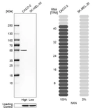 Western blot analysis in human cell lines Caco-2 and SK-MEL-30 using Anti-NXN antibody. Corresponding NXN RNA-seq data are presented for the same cell lines. Loading control: Anti-HDAC1.