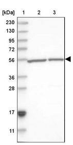 Lane 1: Marker [kDa] 230, 130, 95, 72, 56, 36, 28, 17, 11_br/_Lane 2: Human cell line RT-4_br/_Lane 3: Human cell line U-251MG sp
