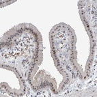 Anti-MSL1 Antibody