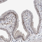 Anti-MSL1 Antibody
