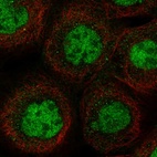 Immunofluorescent staining of human cell line A-431 shows localization to nucleoplasm.