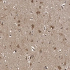 Anti-LLGL1 Antibody