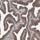 Immunohistochemical staining of human fallopian tube shows moderate cytoplasmic positivity in glandular cells.