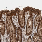 Immunohistochemical staining of human stomach shows strong cytoplasmic and membranous positivity in glandular cells.