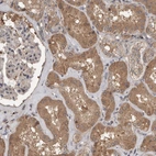 Immunohistochemical staining of human kidney shows moderate cytoplasmic positivity in cells in tubules.