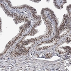 Immunohistochemical staining of human Fallopian tube shows moderate nuclear positivity in glandular cells.