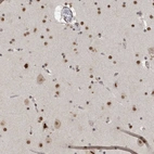 Immunohistochemical staining of human cerebral cortex shows strong nuclear positivity in neurons and glial cells.