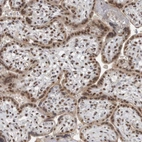 Immunohistochemical staining of human placenta shows moderate nuclear positivity in trophoblastic cells.