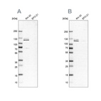 Western blot analysis using Anti-DDX42 antibody HPA023571 (A) shows similar pattern to independent antibody HPA025941 (B).