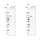 Western blot analysis using Anti-DDX42 antibody HPA023571 (A) shows similar pattern to independent antibody HPA025941 (B).