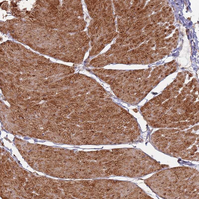 Anti-PHF21A Antibody