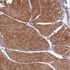 Anti-PHF21A Antibody