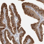 Immunohistochemical staining of human fallopian tube shows moderate cytoplasmic positivity in ciliated and glandular cells.