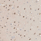 Immunohistochemical staining of human cerebral cortex shows weak cytoplasmic positivity in neurons.