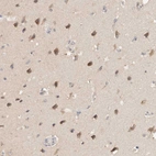 Immunohistochemical staining of human cerebral cortex shows weak cytoplasmic positivity in neurons.
