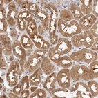 Immunohistochemical staining of human kidney shows moderate cytoplasmic positivity in cells in tubules.