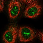 Immunofluorescent staining of human cell line A-431 shows localization to nucleoli.