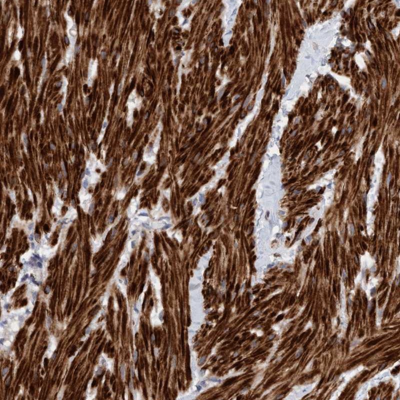 Anti-LONRF1 Antibody