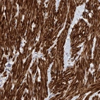 Anti-LONRF1 Antibody