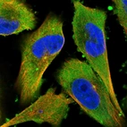 Immunofluorescent staining of human cell line U-251 MG shows localization to plasma membrane, cytosol & centrosome.
