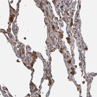 Anti-B3GNTL1 Antibody