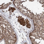 Immunohistochemical staining of human testis shows strong cytoplasmic positivity in Leydig cells.