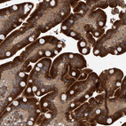 Immunohistochemical staining of human duodenum shows strong cytoplasmic positivity in glandular cells.
