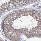 Immunohistochemical staining of human testis shows weak to moderate cytoplasmic positivity in cells in seminiferous ducts.