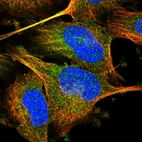 Immunofluorescent staining of human cell line U-251 MG shows localization to cytosol.