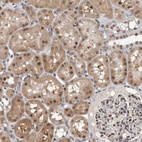 Anti-ZSCAN21 Antibody