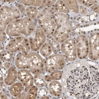 Anti-ZSCAN21 Antibody