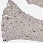 Immunohistochemical staining of human cerebral cortex shows strong nuclear positivity in neurons.