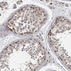 Immunohistochemical staining of human testis shows moderate nuclear positivity in cells in seminiferous ducts.