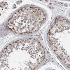 Immunohistochemical staining of human testis shows moderate nuclear positivity in cells in seminiferous ducts.