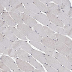 Immunohistochemical staining of human skeletal muscle shows no positivity in myocytes as expected.