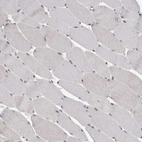 Immunohistochemical staining of human skeletal muscle shows no positivity in myocytes as expected.