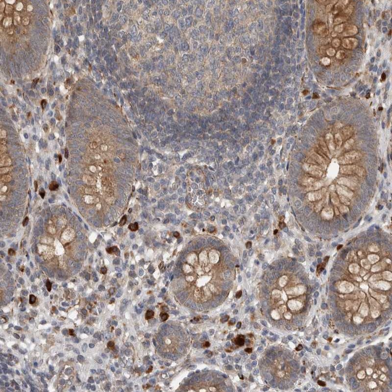 Anti-LBHD1 Antibody