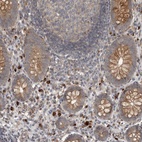 Anti-LBHD1 Antibody